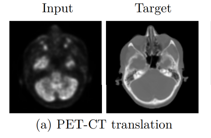 Conversion of PET Scan into synthetic CT Scan with GANs